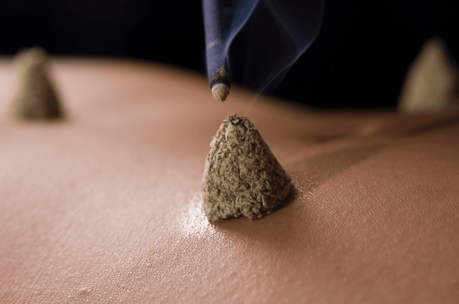 Moxibustion treatments direct on skin